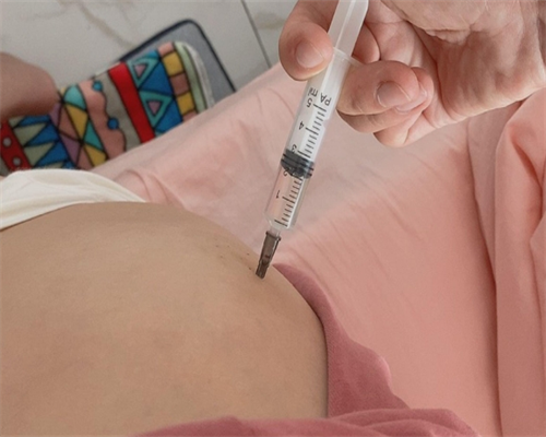 孕期检查频率与注意事项全解析：助您健康孕育