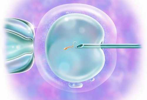 乌克兰供卵生儿子与北京供卵试管公司全面解析及助孕指南