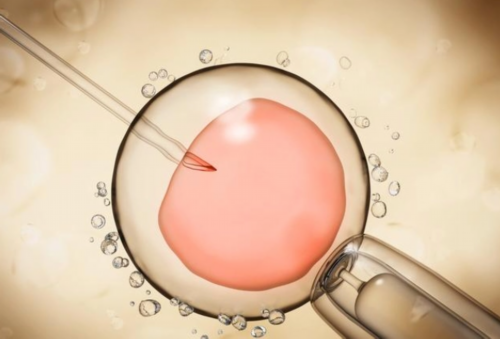 2026年三代试管包男孩费用明细及医院选择指南