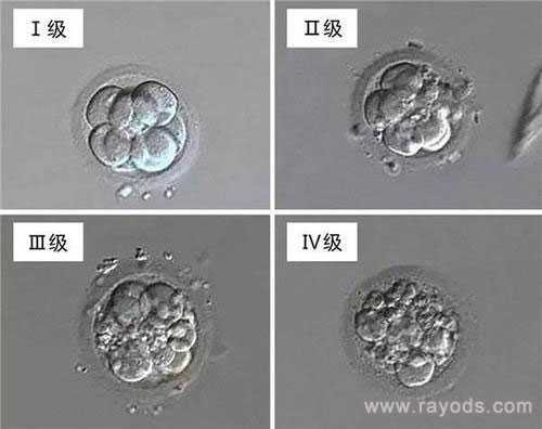 济南金贵子华人供卵可靠吗_怎样判断试管婴儿优质胚胎？