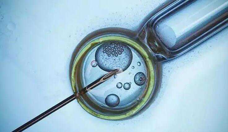 哈尔滨找个农村女人代孕_88477_两步移植法移植两个胚胎成双胞胎的多吗？_035